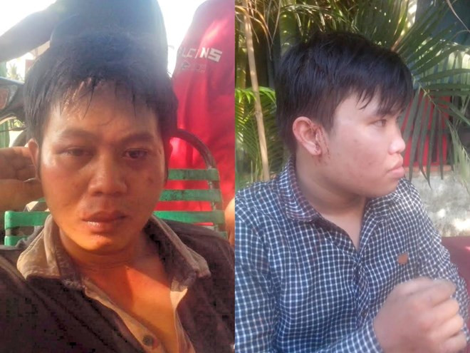 TP.HCM khởi tố vụ án cướp giật tài sản, hành hung phóng viên ảnh 1