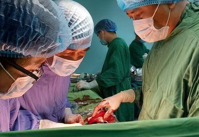 Phẫu thuật thành công cho bệnh nhân mang khối u sarcoma 'khổng lồ' ảnh 1