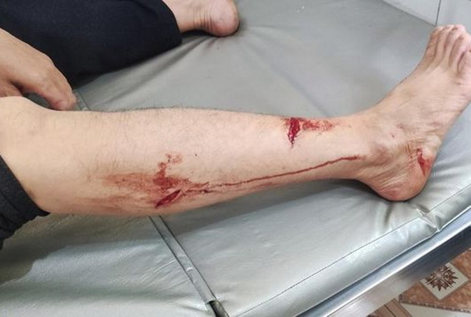 Bắc Kạn: Voọc đen má trắng quý hiếm bất ngờ tấn công người ảnh 1