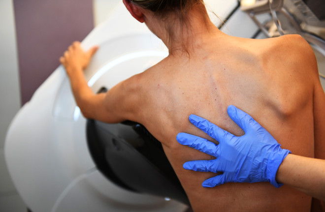 Phát hiện mới mở ra triển vọng trong điều trị bệnh ung thư vú ảnh 1