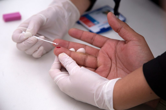 Ảnh minh họa. (Nguồn: Getty Images) Mỗi ngày có hơn 300 trẻ em và trẻ vị thành niên chết vì AIDS ảnh 1