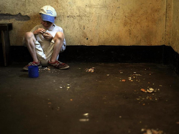 Báo động hủ tục giết trẻ da đen bạch tạng lấy nội tạng hiến tế ảnh 1