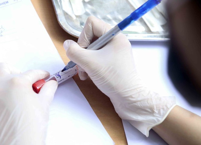 Bổ sung hơn 48 tỷ đồng mua xe xét nghiệm COVID-19 lưu động ảnh 1