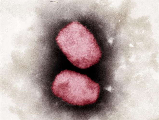 Châu Mỹ là “tâm chấn” của đợt bùng phát dịch bệnh đậu mùa khỉ ảnh 1