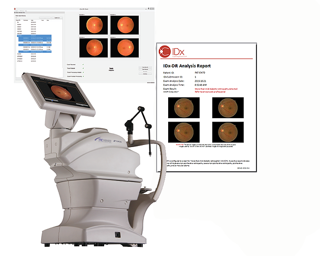 Thiết bị có tên IDx-DR có thể chẩn đoán bệnh màng lưới do tiểu đường. (Nguồn: eyediagnosis.net) Sử dụng trí tuệ nhân tạo chẩn đoán bệnh về mắt do tiểu đường ảnh 1