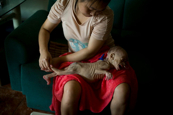 Cảm thương “Công chúa tí hon” mắc căn bệnh lạ ở Trung Quốc ảnh 1