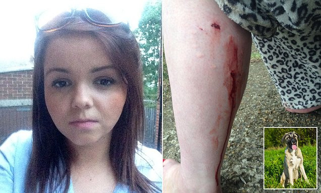 Người chủ đứng yên nhìn chó cưng tấn công cô gái đáng thương ảnh 1