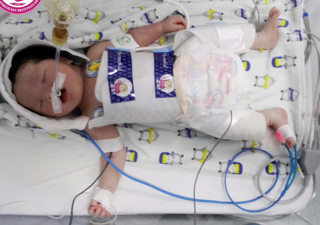Cứu sống một trẻ sơ sinh bệnh não nhờ kỹ thuật hạ thân nhiệt ảnh 1