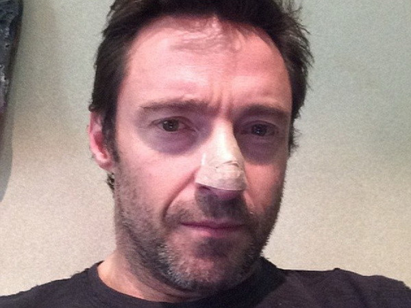 “Người sói” Hugh Jackman phải điều trị ung thư da ảnh 1