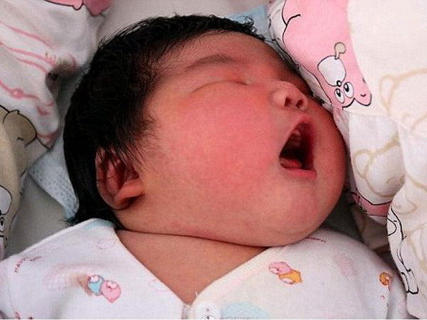 Bác sỹ ngỡ ngàng khi bé trai mới sinh nặng bằng trẻ 3 tháng tuổi ảnh 1