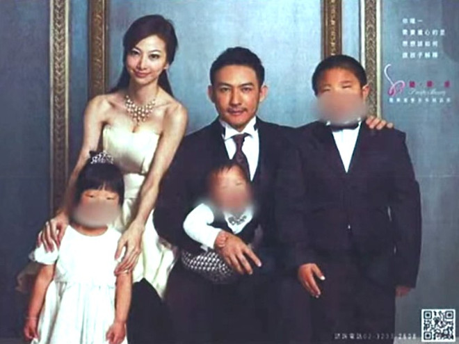 Công bố sự thật về bức ảnh phẫu thuật thẩm mỹ gây tranh cãi ảnh 1