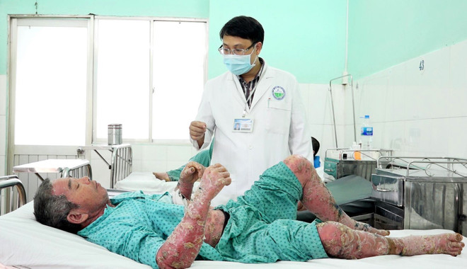 Bác sỹ Nguyễn Vũ Hoàng, Phó Trưởng khoa Lâm sàng 2 - Bệnh viện Da liễu Thành phố Hồ Chí Minh thăm khám cho bệnh nhân. (Ảnh: TTXVN) TPHCM: Tai biến nặng do tự mua thuốc trên mạng chữa bệnh vảy nến ảnh 1