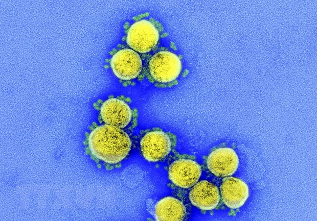 Hình ảnh từ kính hiển vi do Viện Y tế quốc gia Mỹ cung cấp cho thấy virus SARS-CoV-2 trong mẫu bệnh phẩm của bệnh nhân mắc COVID-19 ở Mỹ. (Ảnh: AFP/TTXVN) Châu Âu giám sát bộ gene các biến thể mới của virus SARS-CoV-2 ảnh 1