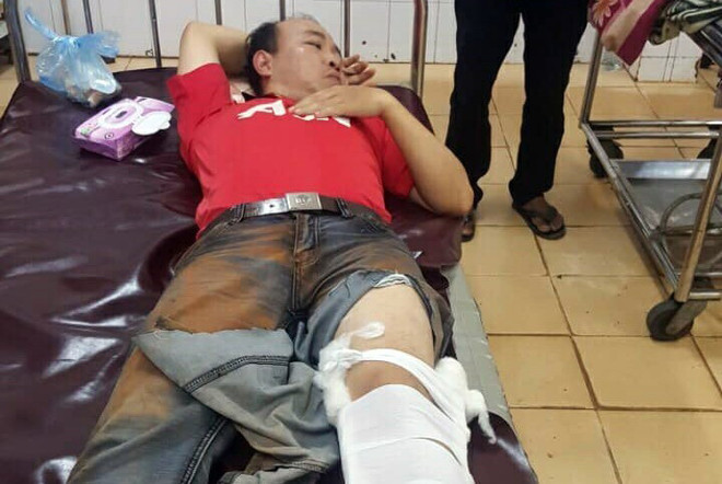 Ông Phan Ngọc Khoa, Hạt phó Hạt Kiểm lâm Krông Nô bị xe càng cán qua chân khi tham gia bắt giữ gỗ lậu. (Ảnh: Hưng Thịnh/TTXVN) Cán bộ kiểm lâm bị thương nặng khi chặn xe chở gỗ trái phép ảnh 1