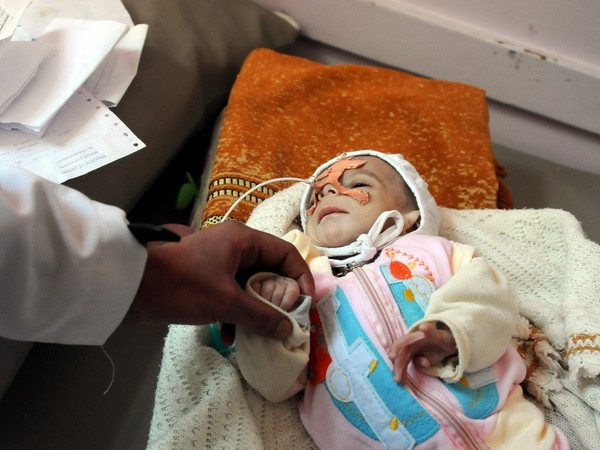 Tổng thống Iran quan ngại về khủng hoảng nhân đạo tại Yemen ảnh 1