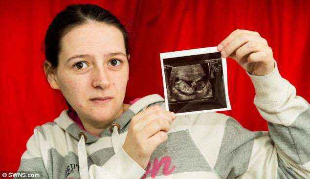 Quyết sinh con dù thai nhi chỉ có 1% cơ hội sống sót ảnh 1