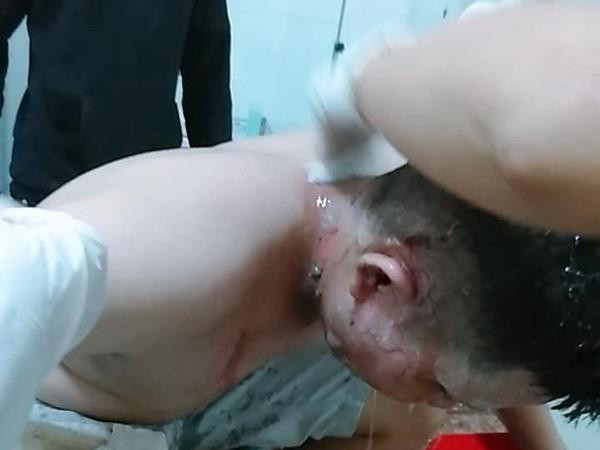 Khởi tố vụ án ném bom xăng làm nhiều người bị thương ở Bình Phước ảnh 1