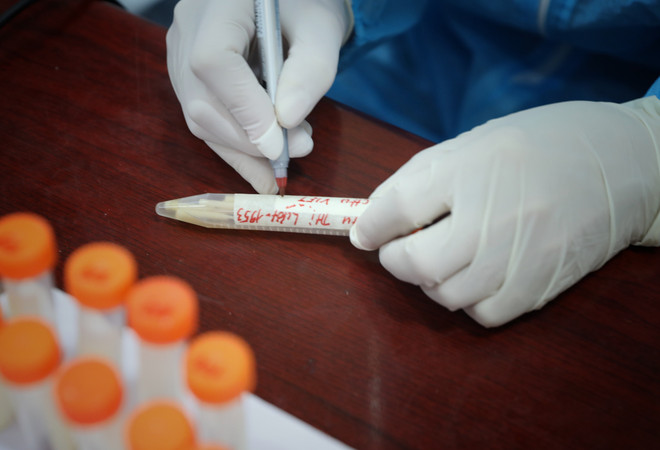 Bắc Giang: Xuất hiện ổ dịch COVID-19 mới tại Yên Thế với 9 ca F0 ảnh 1