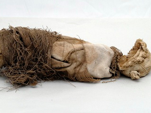 Xác ướp một bào thai hé lộ quy trình phẫu thuật thời cổ xưa ảnh 1