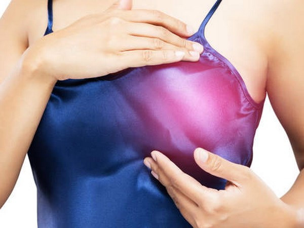 Mỹ phát triển loại thuốc giúp chẩn đoán sớm bệnh ung thư vú ảnh 1