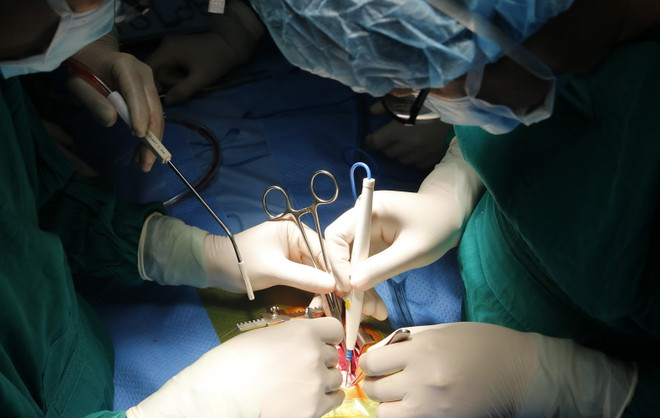 Bệnh viện Sản Nhi Phú Thọ cứu sống bé gái 7 tuổi tắc ruột do nuốt tóc ảnh 1