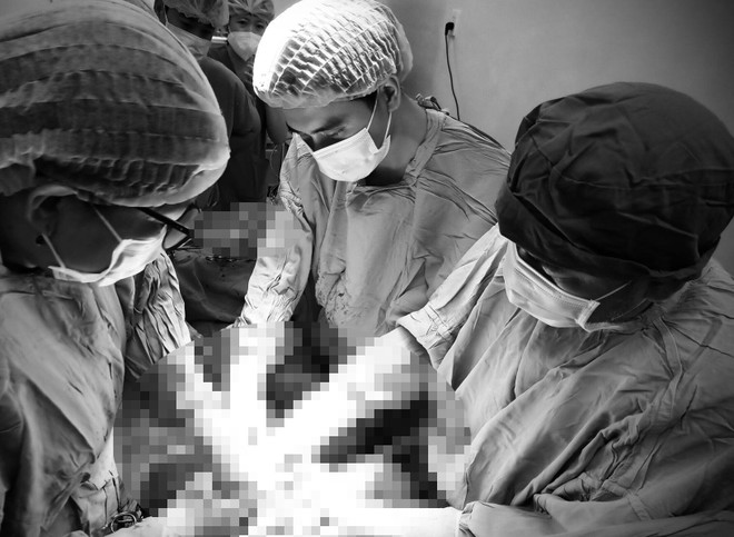 Bệnh viện Phụ sản Cần Thơ phẫu thuật cứu sống mẹ con sản phụ nguy kịch ảnh 1