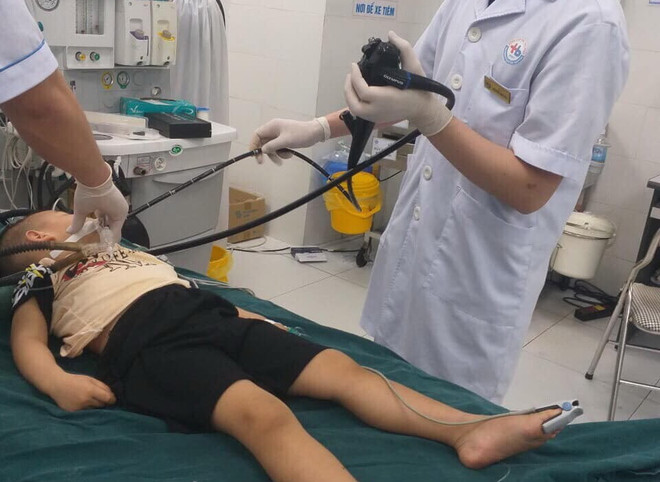 Các bác sỹ Bệnh viện Nhi Thái Bình nội soi tiêu hóa gắp dị vật. (Ảnh: TTXVN phát) Thái Bình: Phẫu thuật kịp thời gắp dị vật trong ruột bệnh nhi 3 tuổi ảnh 1