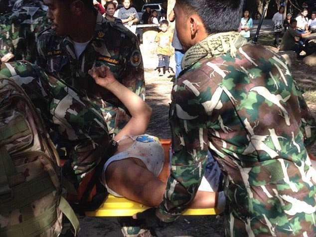 Nữ du khách trả giá đắt vì cố chụp ảnh "tự sướng" cùng cá sấu ảnh 1