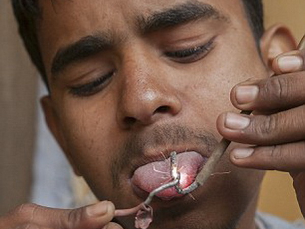 Kinh ngạc cậu bé 16 tuổi bình an dù chạm vào điện trần 11.000v ảnh 2