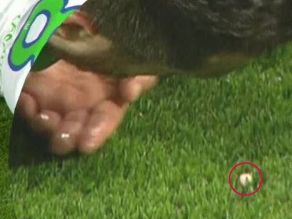 Cầu thủ Wolfsburg gẫy răng sau khi lĩnh trọn cùi chỏ của Kroos ảnh 1