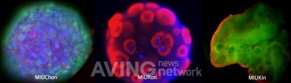 Hình thức trị liệu tế bào khác nhau sử dụng tế bào gốc đa năng cảm ứng ảnh 2