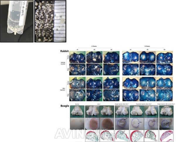 Hình thức trị liệu tế bào khác nhau sử dụng tế bào gốc đa năng cảm ứng ảnh 3