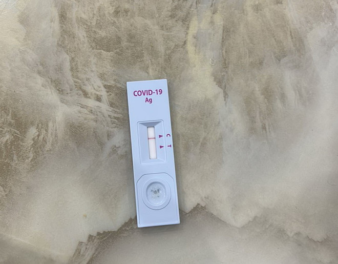 Có hiện tượng đầu cơ, tăng giá bộ sinh phẩm xét nghiệm SARS-CoV-2 ảnh 1