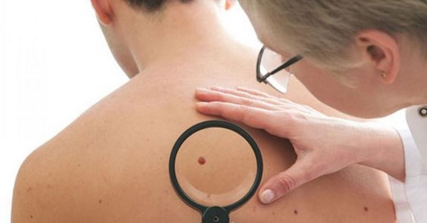 Israel phát hiện phương pháp khắc phục kháng thuốc ở khối u ác tính ảnh 1