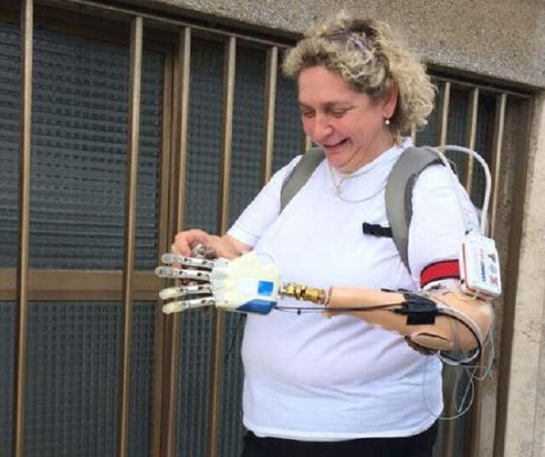 Công nghệ Sinh Điện tử mang đến hy vọng cho người tàn tật ảnh 1