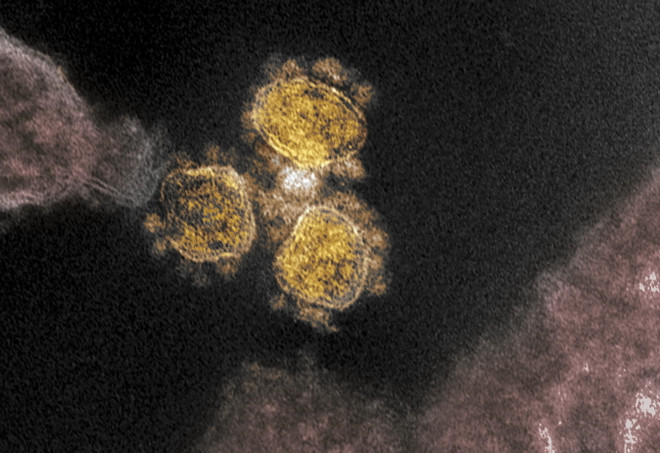 Cảnh báo nguy cơ bùng phát các ca nhiễm biến thể Lambda tại Mỹ ảnh 1