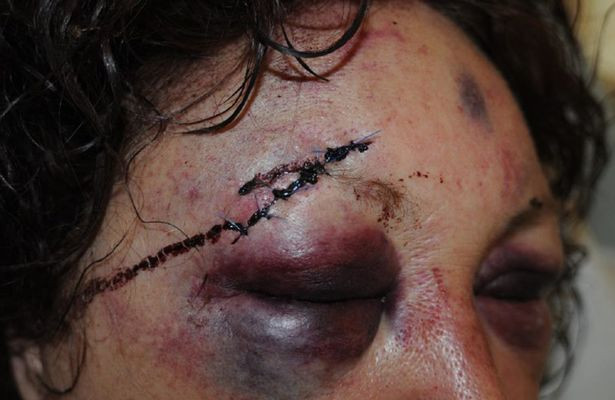 Kẻ hiếp dâm sa lưới pháp luật vì bị nạn nhân dùng máu đánh dấu ảnh 1