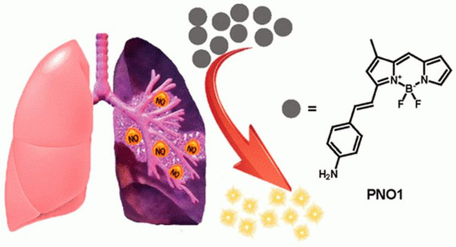 Các nhà khoa học tìm ra cách phát hiện sớm bệnh xơ phổi ảnh 1