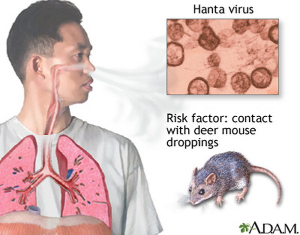 Bùng phát dịch bệnh nguy hiểm lây từ chuột sang người ở Argentina ảnh 1
