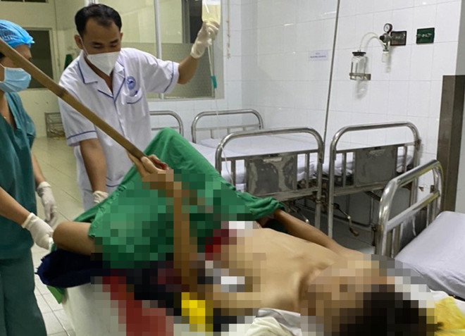 Tây Ninh: Cứu kịp thời bệnh nhân bị dao cạo mủ cao su đâm thủng bụng ảnh 1