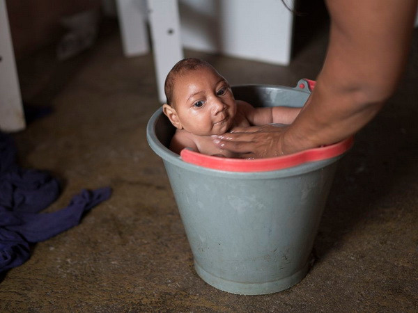 Virus Zika gây ra bệnh đầu nhỏ đang hoành hành tại Mỹ Latinh ảnh 1