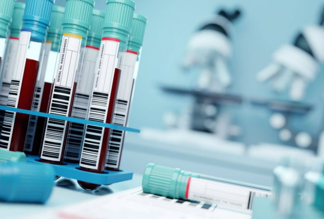 Nga cảnh báo khả năng gia tăng số ca nhiễm virus Tây sông Nile ảnh 1