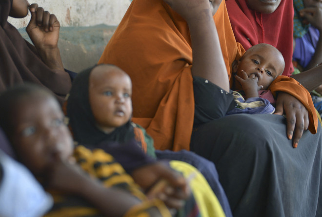 Trẻ em suy dinh dưỡng được điều trị tại Baidoa, Somalia. (Nguồn: AFP/TTXVN) WFP cần 351 triệu USD để cứu trợ ở Somalia trong 6 tháng tới ảnh 1