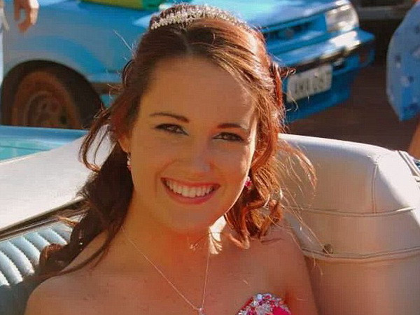 Suýt mất mạng vì dị ứng với thuốc điều trị bệnh động kinh ảnh 1