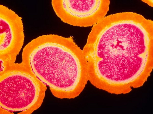 Phát hiện mới giúp giảm thiểu tình trạng kháng thuốc kháng sinh ảnh 1