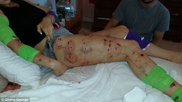 Chó pitbull tấn công dã man chủ và 2 cô gái chạy trên đường ảnh 2