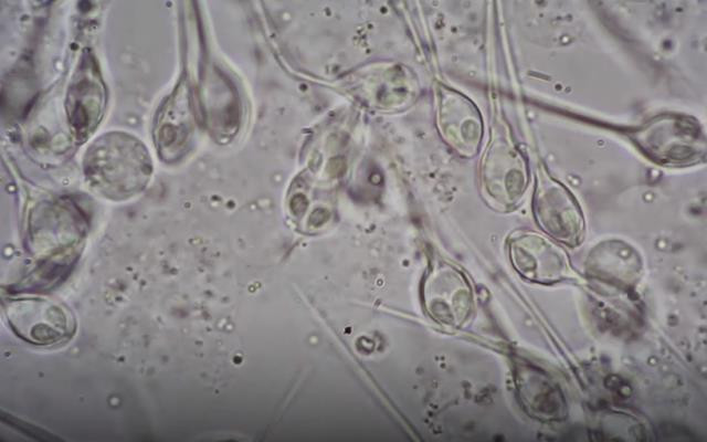 Henneguya salminicola dưới kính hiển vi. (Nguồn: https: timesofisrael.com) Phát hiện loài động vật đầu tiên trên thế giới không thở khí oxy ảnh 1