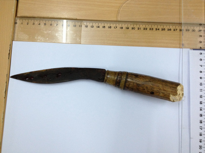 Cứu bé trai 11 ngày tuổi bị người phụ nữ đâm dao xuyên qua sọ ảnh 3