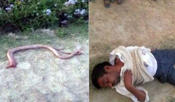 Người đàn ông phải nhập viện vì cố cắn con rắn để trả thù ảnh 1