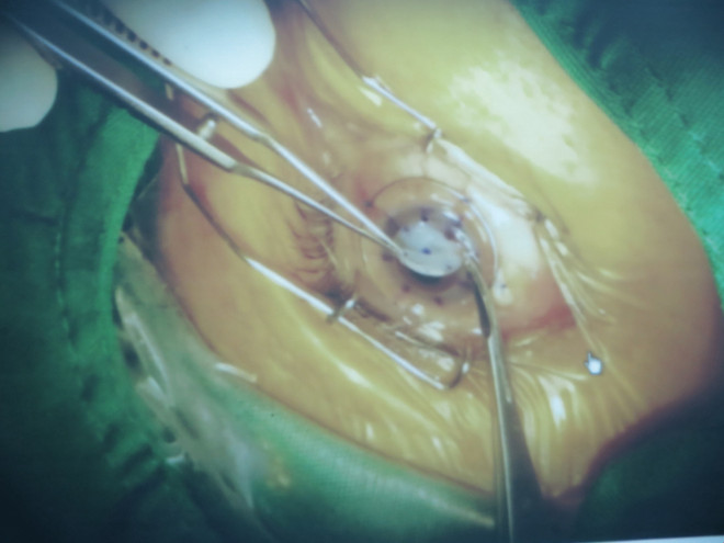 Sự kiện trong nước 30/7-5/8: Tuyên án phạt đối với Vũ "nhôm" ảnh 5